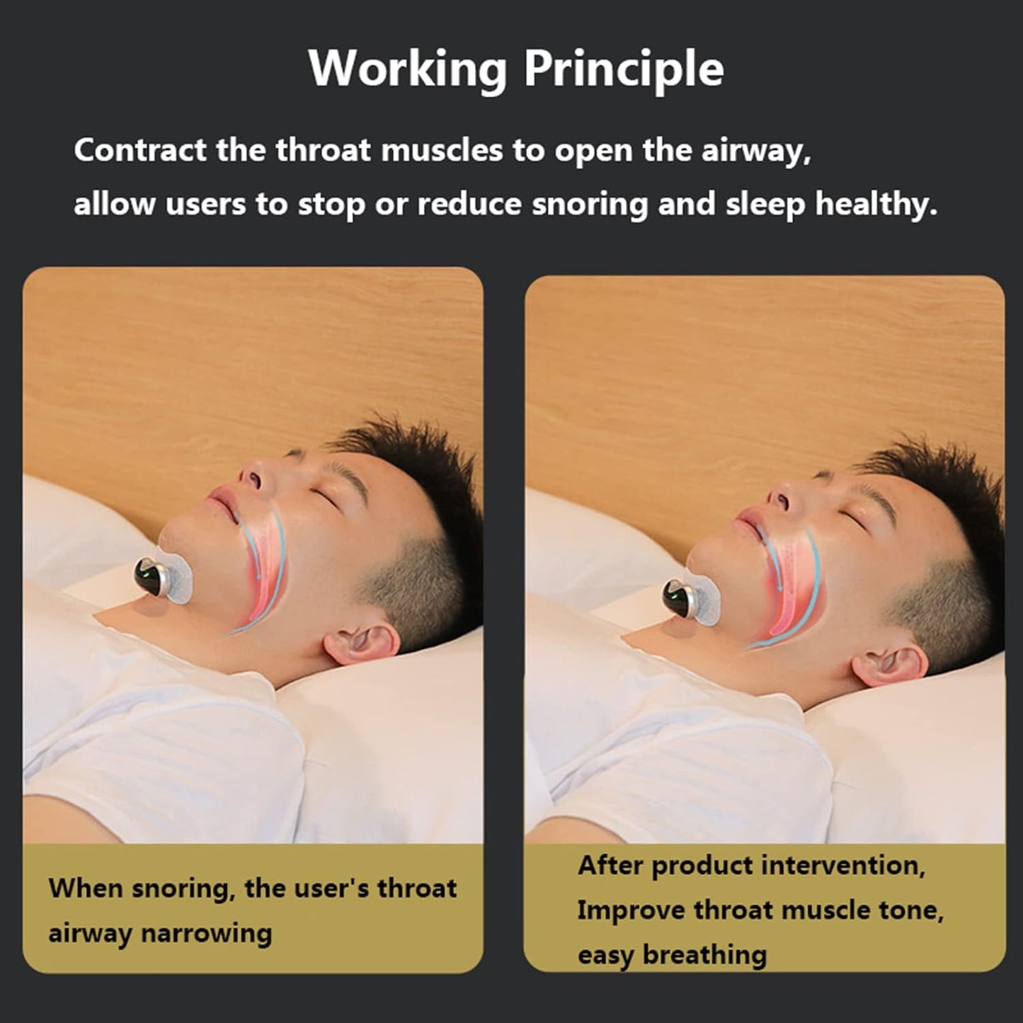 Smart Throat Anti Snoring Device Snoring Detection - By Impulse Sense Pulse Technology