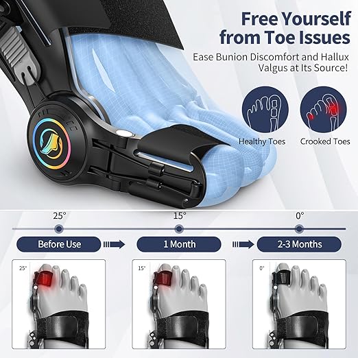 FlexToe Professional Hallux Valgus Corrector (1 piece, fits both left and right feet)
